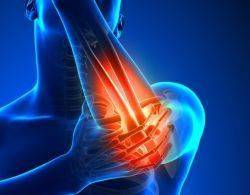 علاج الروماتيزم بأبسط الطرق