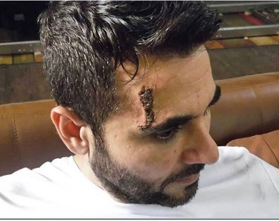 إصابة أحمد عز... ماذا حدث؟