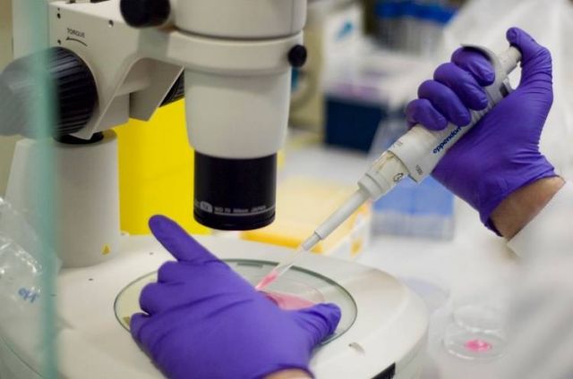 هذا هو القاتل الذي يعيش فوق أجساد البشر