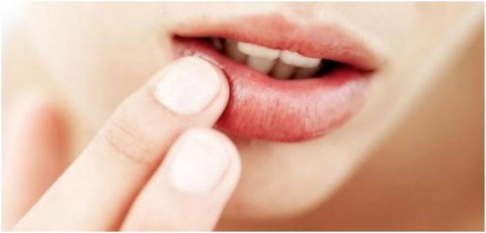 إسمرار الشفاه.. الأسباب والحلول