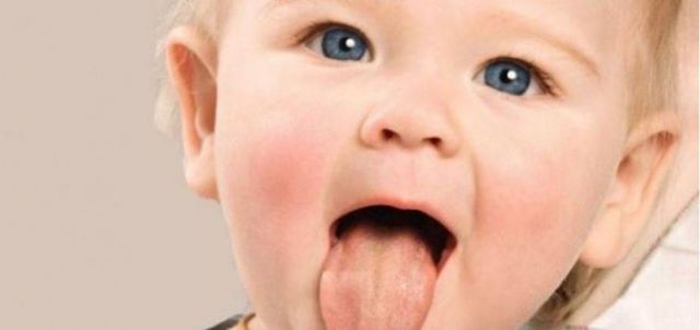 فطريات الفم عند الأطفال قد تكون علامة لنقص المناعة
