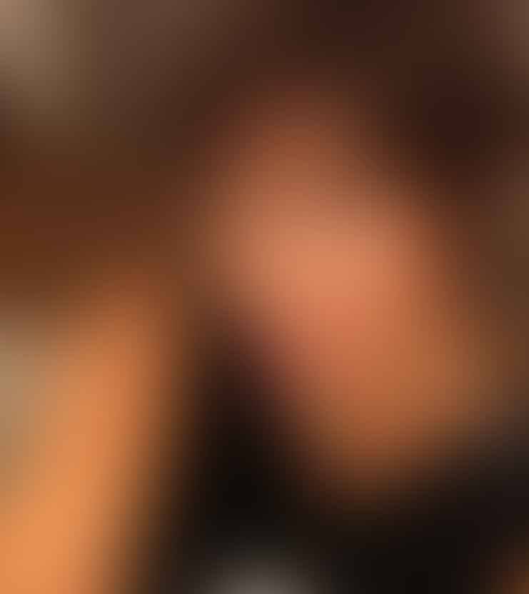 بالفيديو – فنانة لبنانية تثير الجدل بتغيير ملامحها وانتفاخ وجهها... هذا ما طلبته في عيادة التجميل