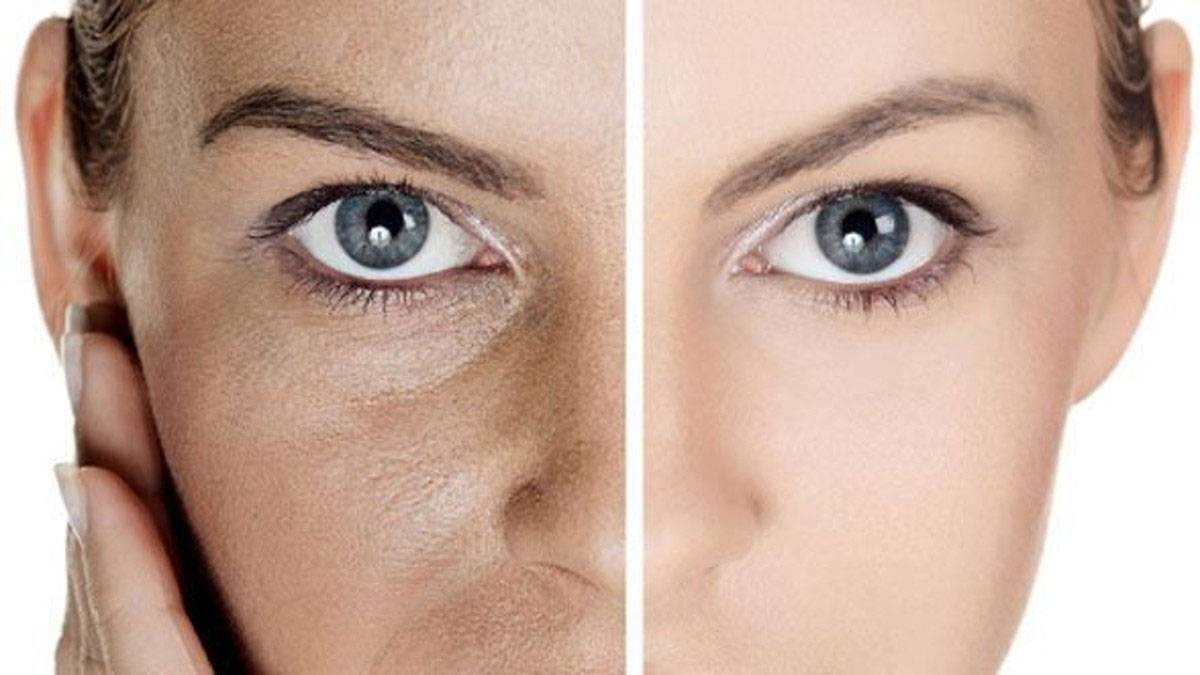 لبشرة مشرقة.. نصائح بسيطة للتخلص من المسام الواسعة