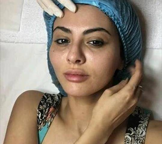 مريم حسين تثير الجدل بفيديو جديد.. ما قصة خضوعها لعملية تجميل؟