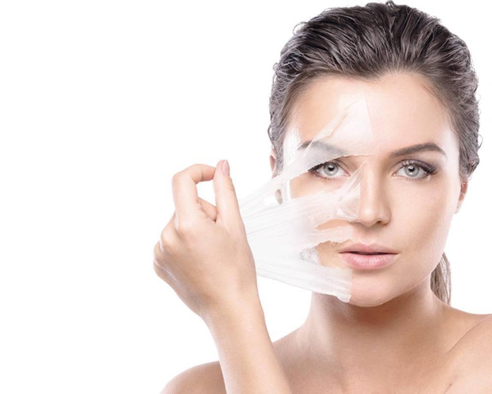 حلول  للتخلص من
البقع الداكنة