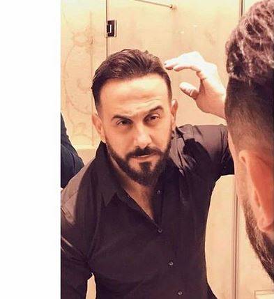 بالصور - قصي خولي تعرض لتشوه في يده.. شاهدوا ماذا حصل