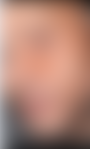 بالصور - إصابة نجم مصري بشظايا في وجهه.. وهذه حالته الصحية الآن