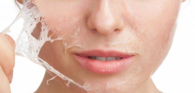 قبل الصيف... ما هي الحلول البسيطة لمعالجة تقشر البشرة؟