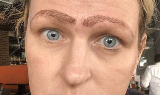 بالصورة – أصبحت بـ 3 حواجب بسبب عملية تجميل... شاهدوا كيف تشوّه وجهها