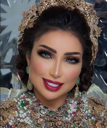 بالصور -  بعد تجميل شفاهها على شكل قلب.. شاهدوا دنيا بطمة لن تتعرفوا عليها