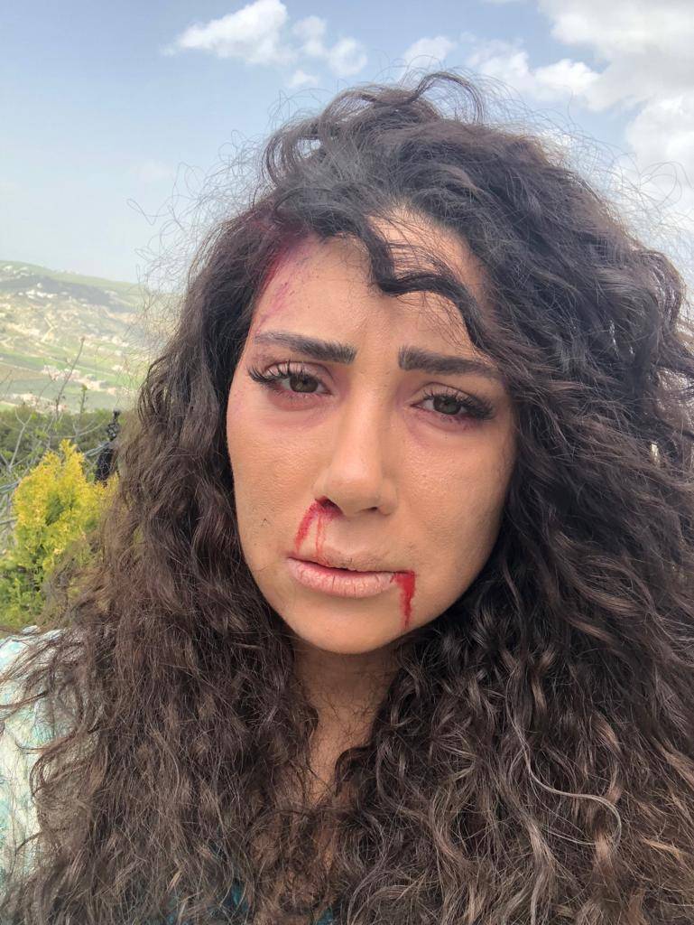 بالصور - من ضرب الفنانة اللبنانية نور صعب؟