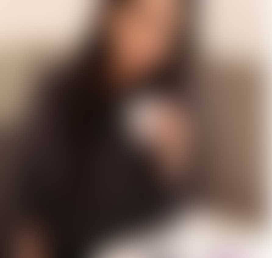 بالصورة – نجمة شهيرة تكشف كيف يغطي حب الشباب وجهها من دون مكياج... وهذا السبب