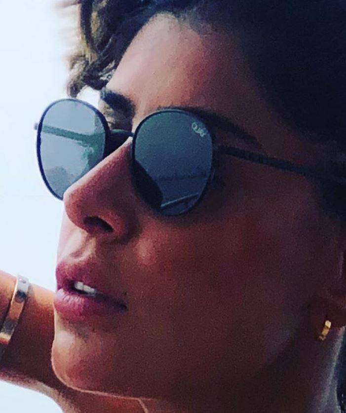 بالفيديو – ممثلة خليجية بعد التجميل: 