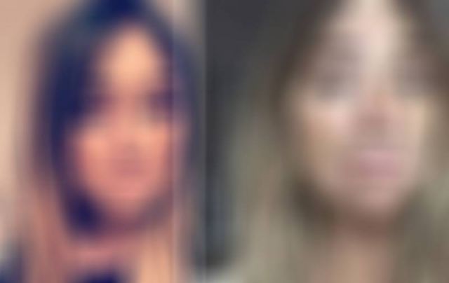 التسمير يشوه وجه هذه الفنانة...