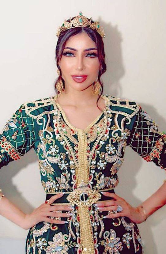 بالصور – انتقادات لهذا التفصيل في إطلالة دنيا بطمة... ماذا فعلت لتبدو أكثر طولاً ونحافة؟