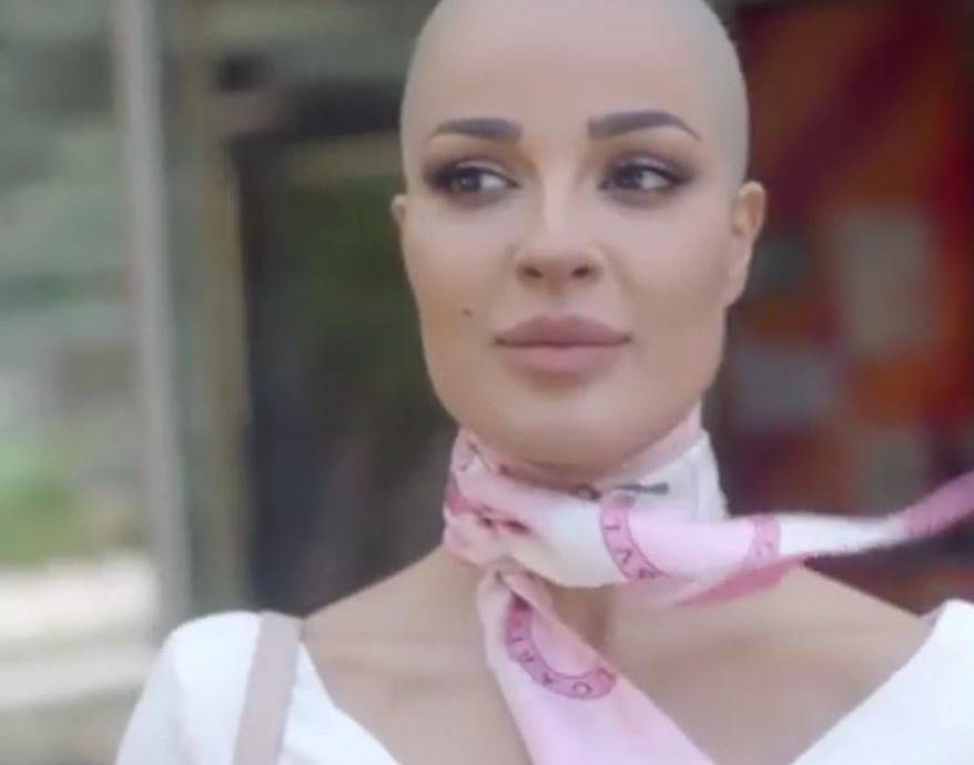 بالصورة – فتاة تشعل المواقع بحلق رأسها مثل نادين نسيب نجيم... هل هي مريضة سرطان؟