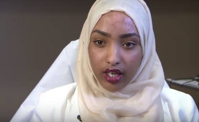 بالصور – شوهوا وجهها بالماء المغلي... شاهدوا كيف أصبحت بعد التاتو