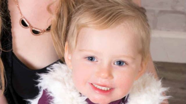 طفلة تصاب بالتشوه في وجهها بسبب قبلة... إعرفوا السبب واتنتبهوا