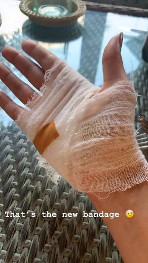 ياسمين صبري تلف يدها بشاش طبي