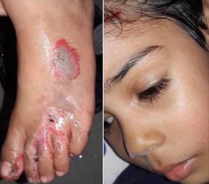 بالصور - ممثل مصري يهدد سائقاً دهس ابنه بفصل رأسه عن جسده