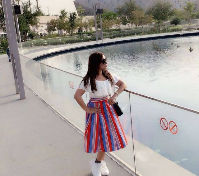 بالصورة – احتراق وجه فنانة خليجية لهذا السبب... تحتاج إلى أشهر من العلاج