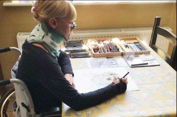 مرض نادر ومخيف - رأسها مهدد بالسقوط في كل لحظة... هذه قصتها الصادمة