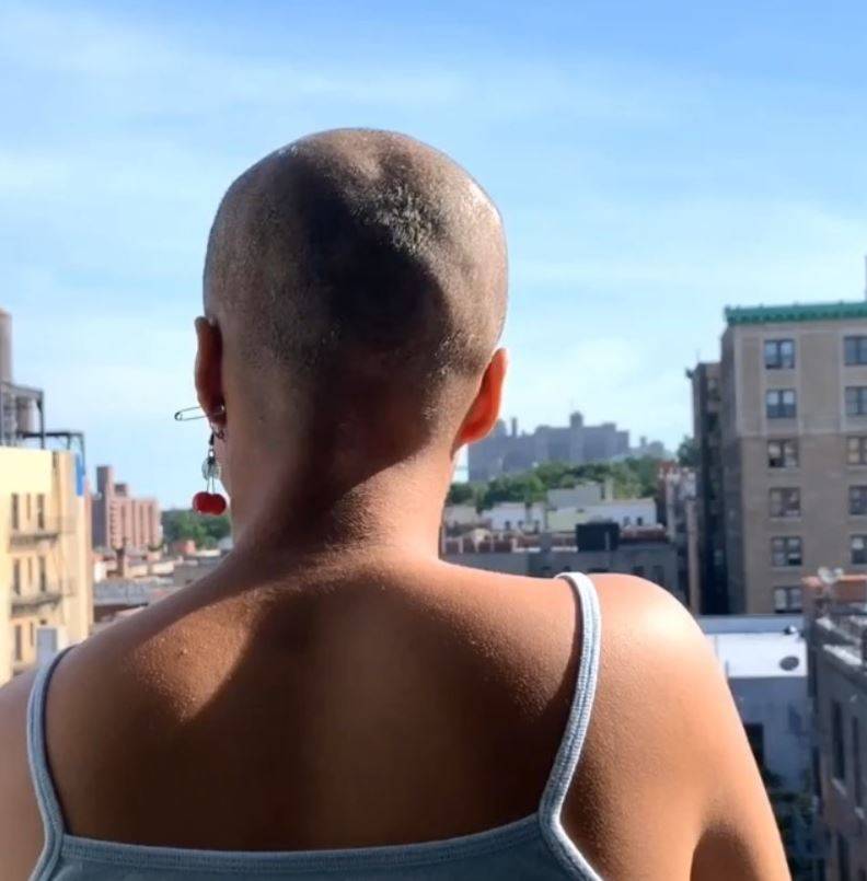 بالصورة - أصبحت صلعاء بسبب إزالتها صبغة شعرها... انتبهي لما حدث معها