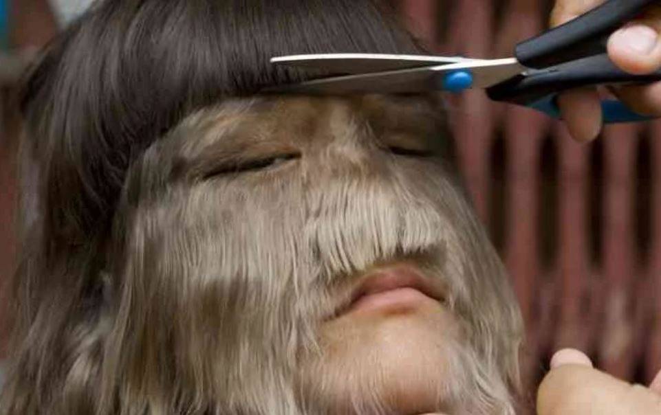 هل تتذكرون الفتاة التي يغطي الشعر وجهها؟ إليكم ما حدث معها وكيف تغيرت