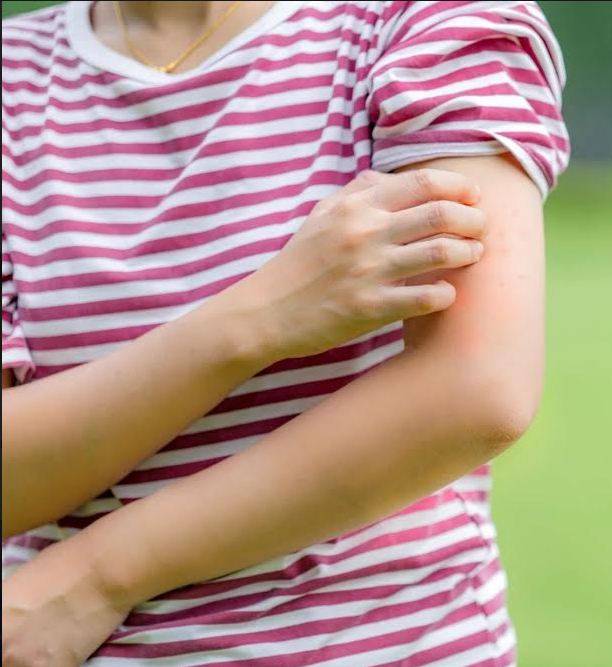 طريقة الملعقة للتخلص من حكة لسعة الناموس المزعجة في دقائق