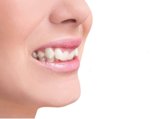 الابتسام بهذه الطريقة يسبب هذه الامراض الخطرة... لم تفكروا بهذا يوماً