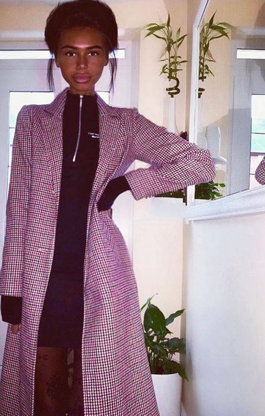 بالصور- هذه الفتاة كانت شقراء وبيضاء البشرة... إليكم قصة إدمانها على التسمير