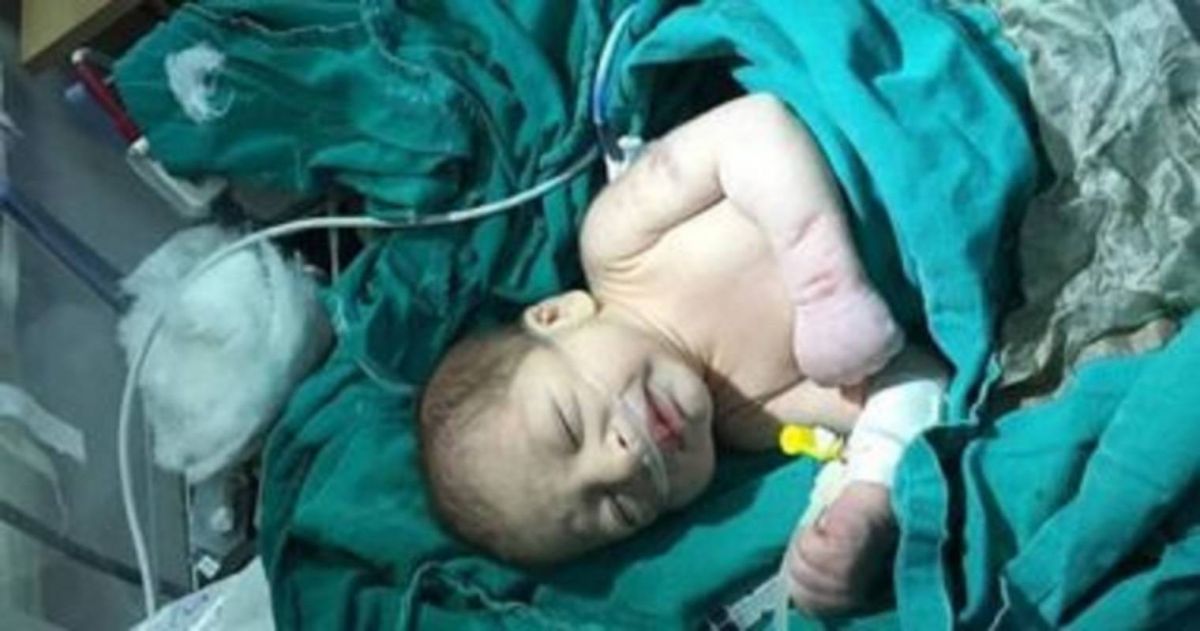 طبيب يتجرد من إنسانيته ويلقي ابنه في القمامة