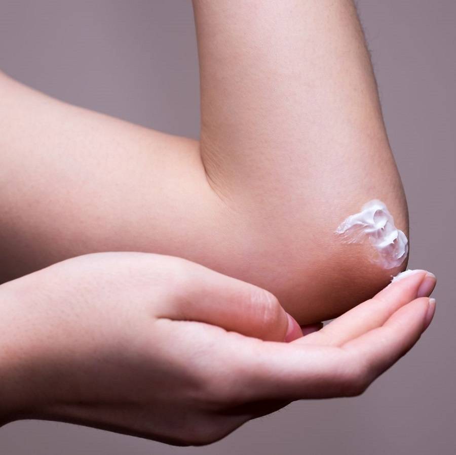 بالليمون ومعجون الأسنان فقط تحصلين على مرفقين كبياض الثلج... جربي الوصفة