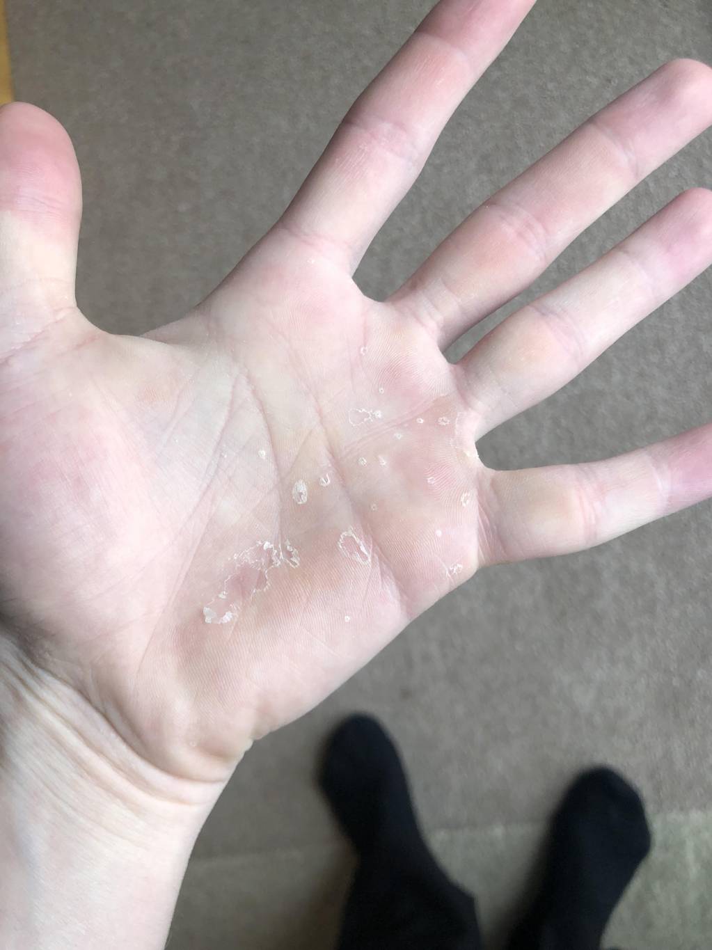 هل تعانين من تقشر الجلد؟ إليك السبب وهذا هو العلاج الطبيعي الفعال