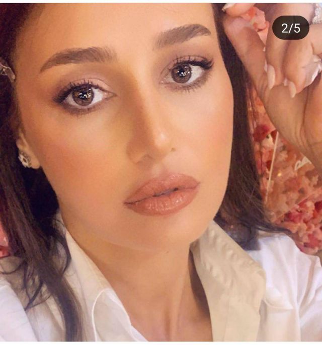 هل خضعت حلا شيحة لعملية تجميل ثانية؟