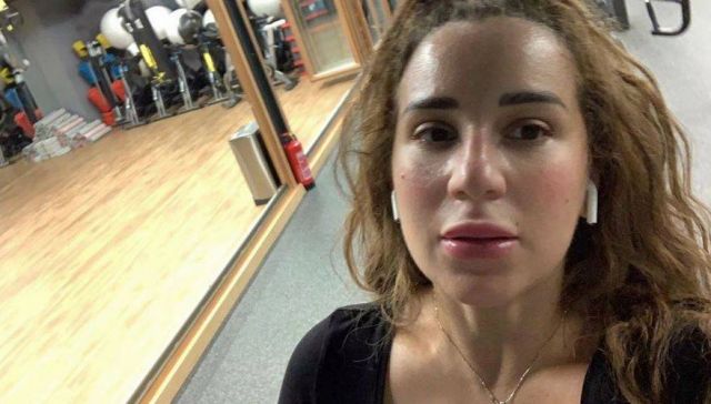 بالصورة - هذا التفصيل في وجه أسما شريف منير يثير الجدل... ما الذي لفت الأنظار؟