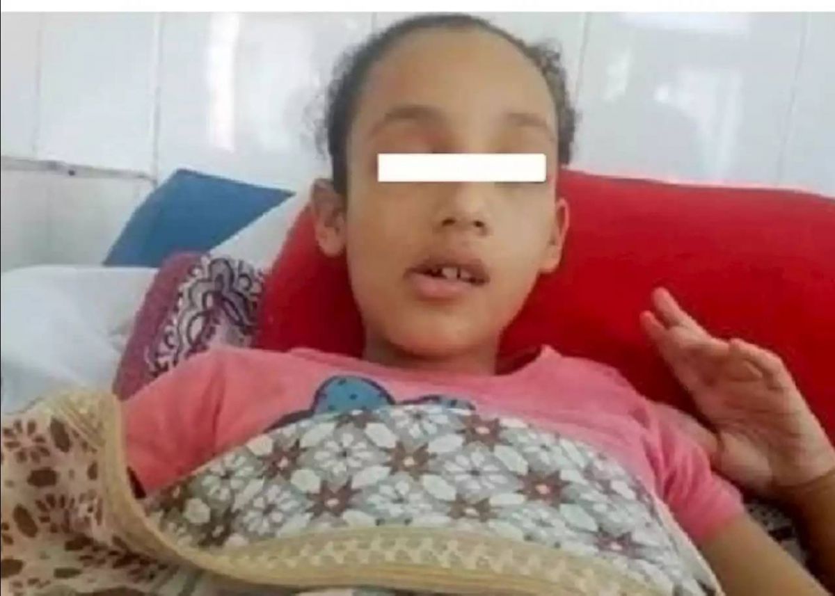 روان طفلة تعرضت للتنمر فكانت النتيجة 