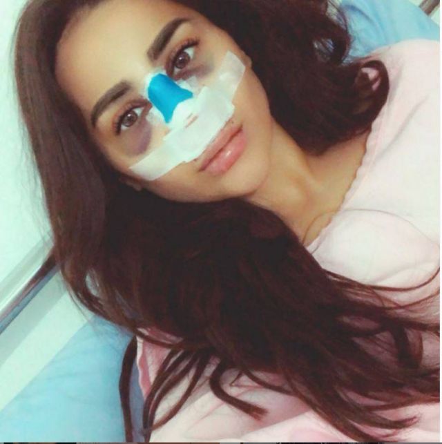 بالفيديو – فنانة لبنانية تظهر بضمادة وورم على وجهها... ما القصة؟