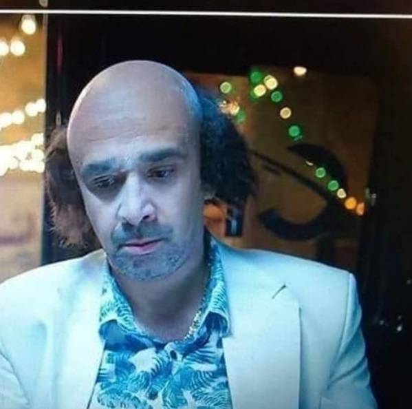 بعد ظهور كريم عبد العزيز بإطلالة غريبة.. هذا الفنان يسخر من صلعته