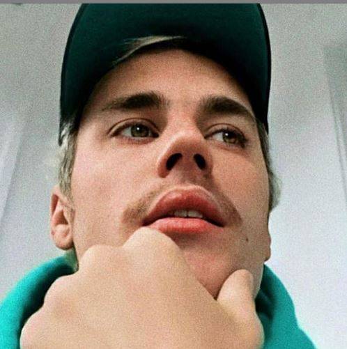 بعد إعلان جاستين بيبر عن إصابته بهذا المرض الخطير.. هذا ما يحصل من دون علاج