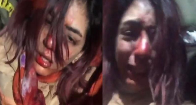 بالفيديو - تعرض فنانة عربية لضرب وحشي