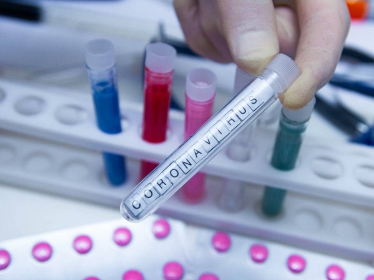 دراسة -  ما علاقة الهواء بانتشار فيروس كورونا في إيطاليا؟