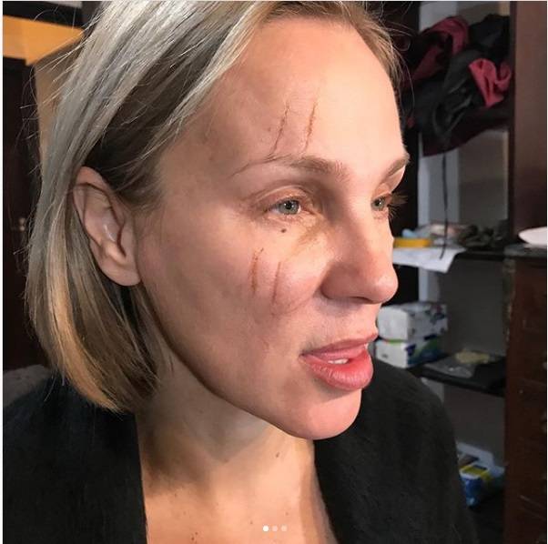 حقيقة إصابة شيرين رضا