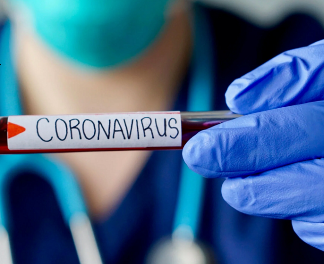 فيروس كورونا ينهي حياة هذا الفنان العالمي