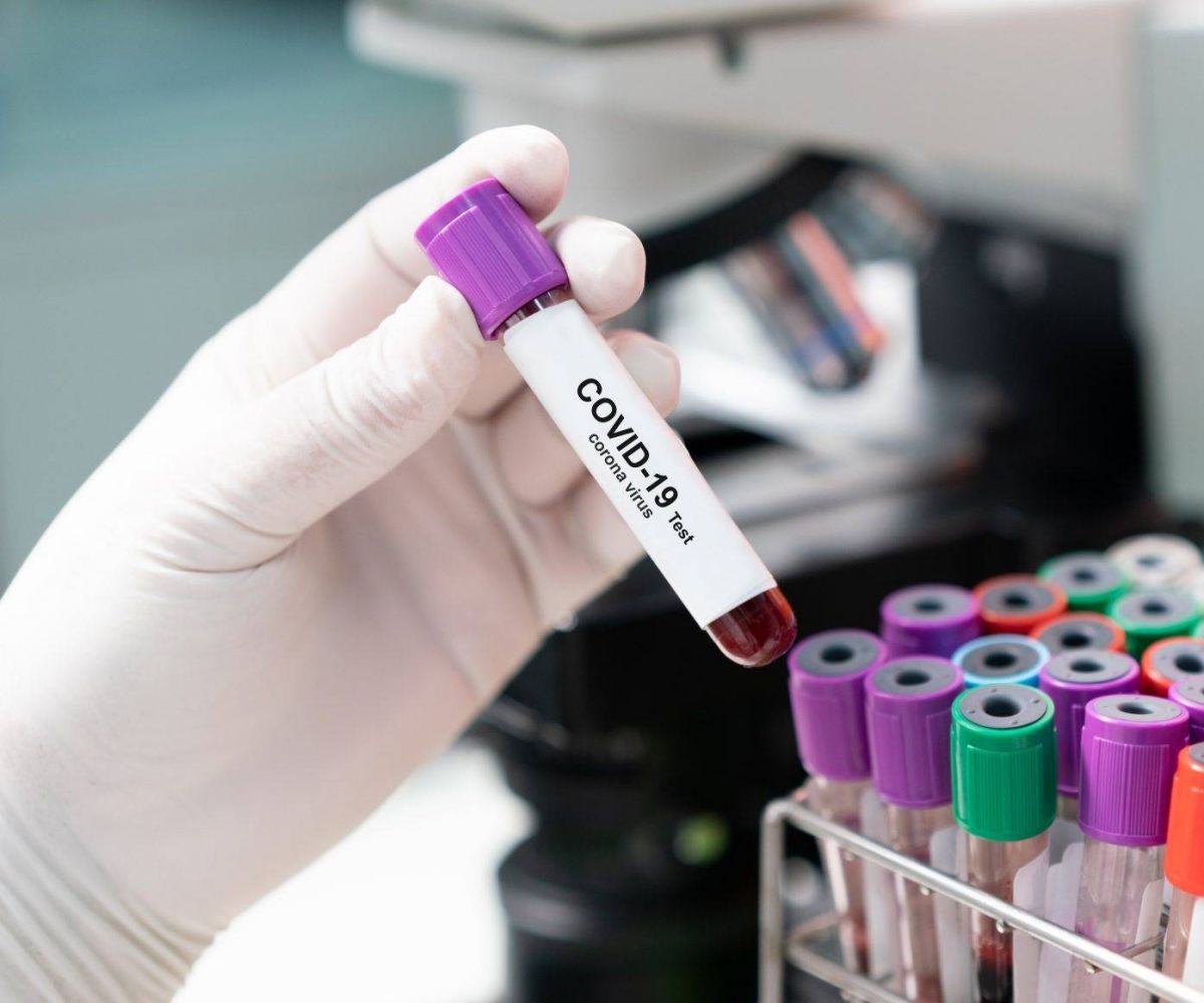 هل يدل احمرار العينين على الإصابة بفيروس كورونا؟