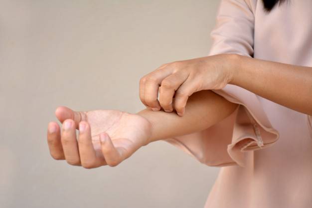 مشاكل بشرة ترتبط بفيروس كورونا المستجد