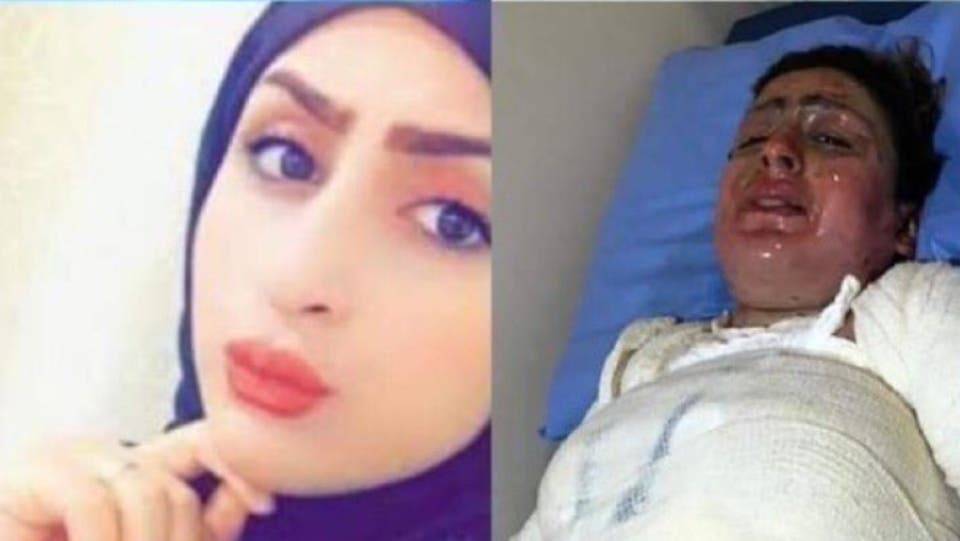 تطورات صادمة في قضية ابنة النجف التي أحرقت نفسها.. وأبكت العراقيين