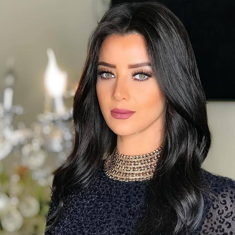 صورة تكشف كيف كان شكل رضوى الشربيني قبل خسارة 30 كيلوغراماً