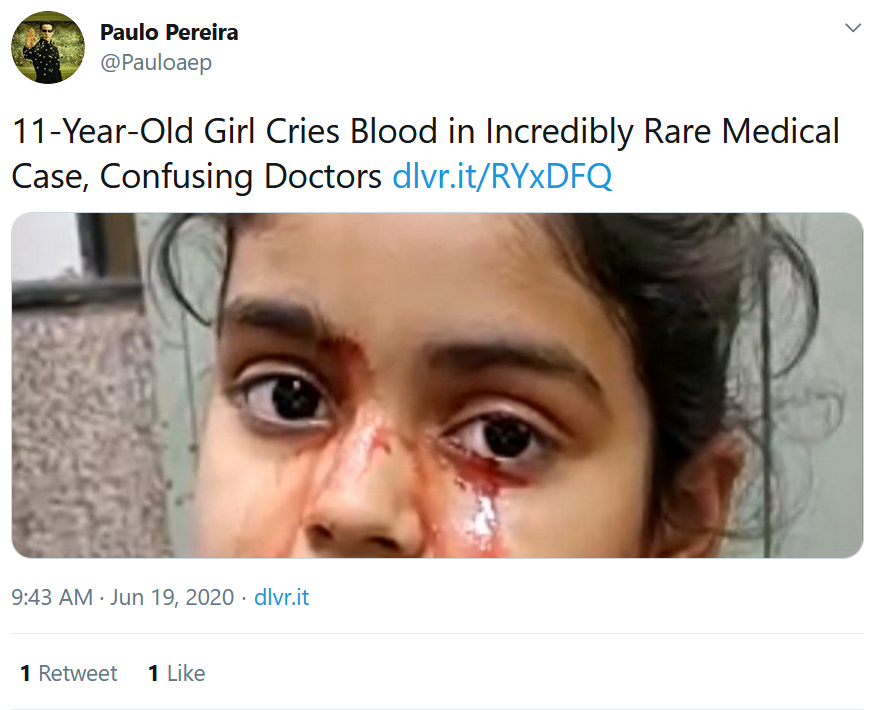 تذرف الدمع بدلاً من الدموع وتحير الأطباء