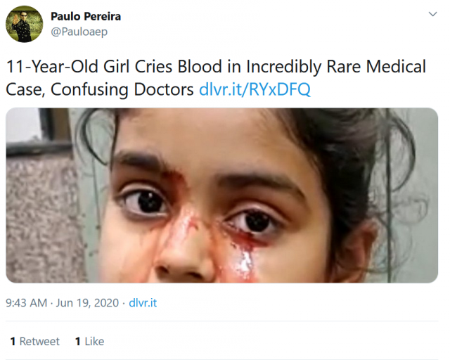 تذرف الدمع بدلاً من الدموع وتحير الأطباء